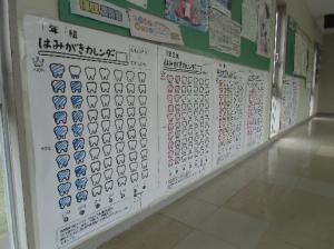 歯②